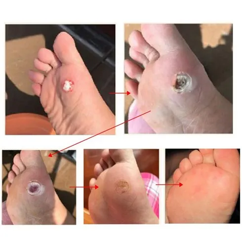 뜨끈뜨근 리커버풋 혜택ON