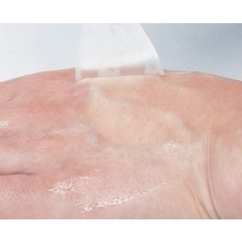 기회는 아무때나 오는게 아니다 꼭 갖고싶은 ​미간주름패치 제가 소개해 드립니다 단 하루의 혜택